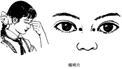 睛明穴